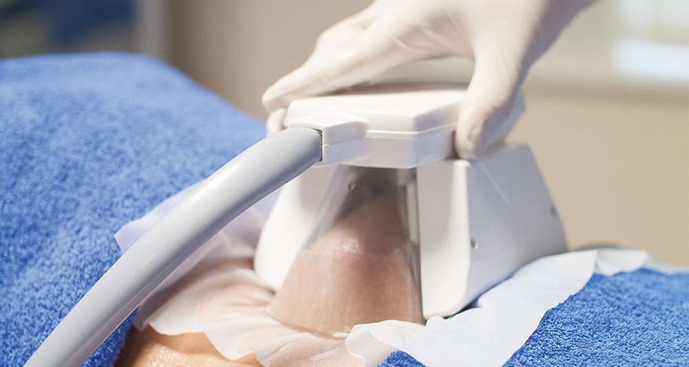 How Fat Freezing and HIFU Work Together? 2 Multiple Areas in One Session HIFU and Fat Freezing Lowestoft