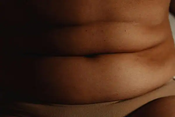 The Hidden Connection: How Stress Shapes Your Fitness and Body Composition 3 image of what stress can do on the stomach area and how Lipo 360 Lowestoft can help to change your body shape.