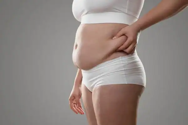 Image of stress belly Lowestoft How Lipo 360 can help manage your symptoms